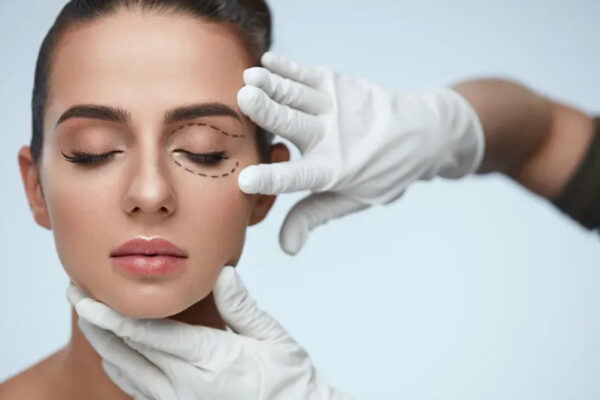 layanan bedah - Blepharoplasty