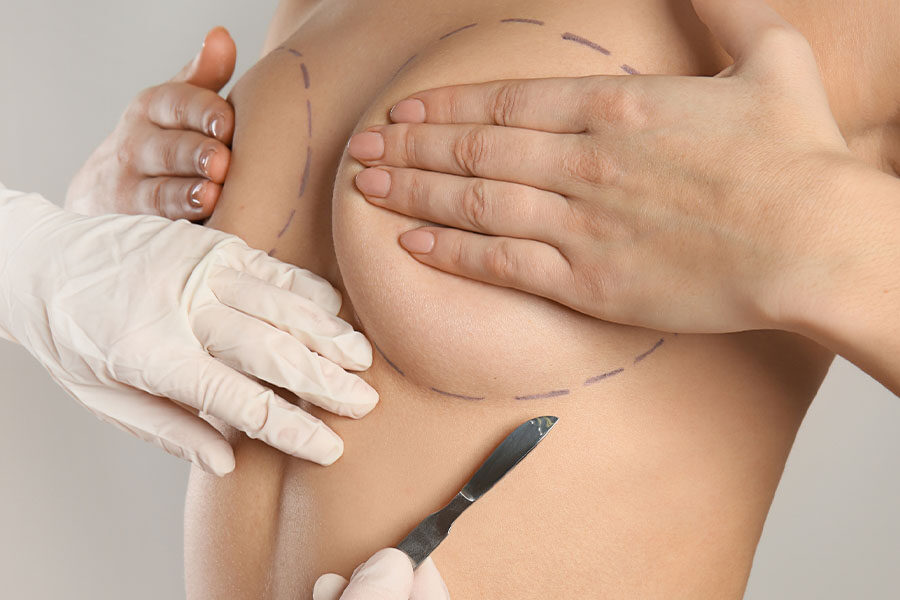 layanan bedah - Breast Augmentation