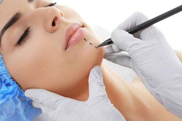 layanan bedah - Implant Dagu