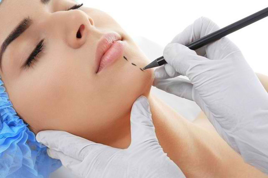 layanan bedah - Implant Dagu