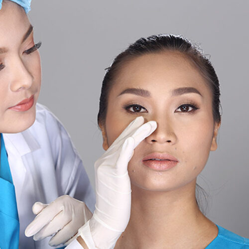 layanan bedah - Rhinoplasty