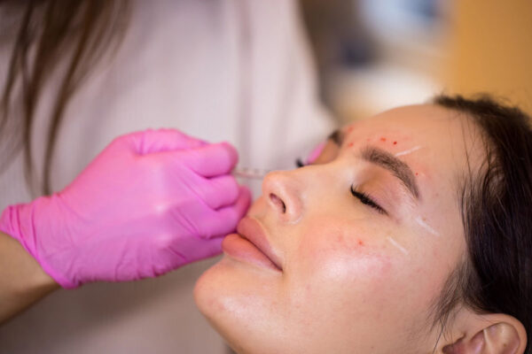 layanan non bedah - Exosome