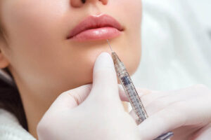 layanan non bedah - Filler