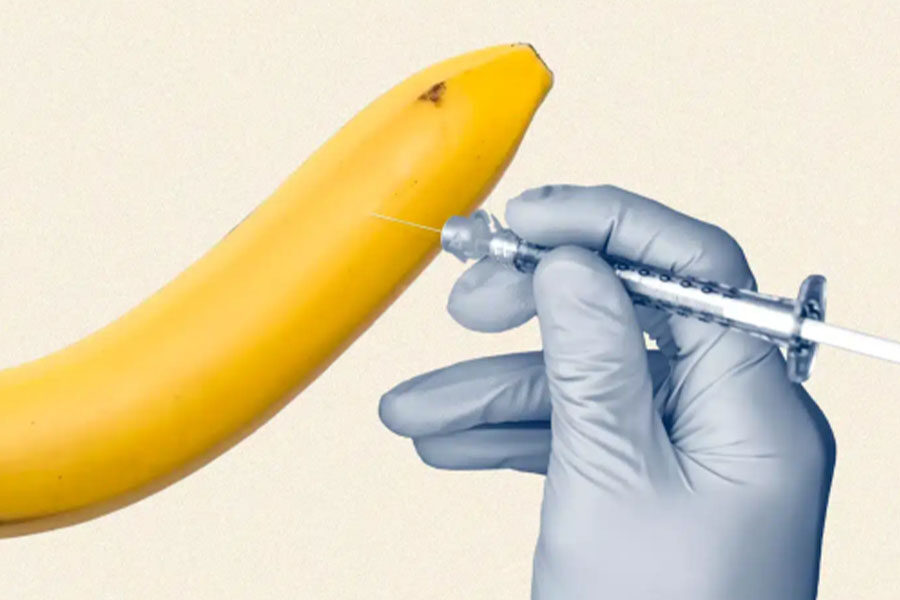 layanan non bedah - P-Shoot